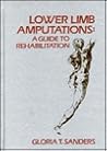 Lower Limb Amputations: A Guide to Rehabilitation