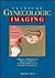 Clinical Gynecologic Imaging