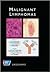 Malignant Lymphomas (Atlas of Clinical Oncology.)