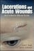 Lacerations and Acute Wounds by Adam J. Singer
