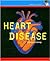 Heart Disease