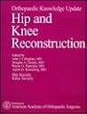 Orthopaedic Knowledge Update: Hip and Knee Reconstruction Orthopaedic Knowledge Update: Hip and Knee Reconstruction