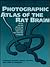 Photographic Atlas of the Rat Brain: The Cell and Fiber Architecture Illustrated in Three Planes with Stereotaxic Coordinates