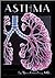 Asthma (Single Title: Science: Health and Human Disease)
