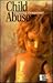 Child Abuse: Opposing Viewpoints
