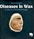 Diseases in Wax by Thomas Schnalke Diseases in Wax by Thomas Schnalke