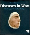 Diseases in Wax: the History of Medical Moulage (Hardcover)