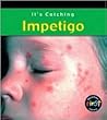 Impetigo (It's Catching) Impetigo (It's Catching)