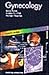 Gynecology by Janice Rymer MD  FRCOG  FRA...