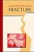 Fracture
