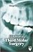 Handbook of Third Molar Surgery