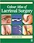 Colour Atlas of Lacrimal Surgery