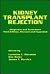 Kidney Transplant Rejection...