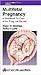 Multifetal Pregnancy: A Handbook for Care of the Pregnant Patient (LWW Handbook Series)
