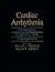 Cardiac Arrhythmia: Mechani...