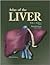 Atlas of the Liver (Atlas of Diseases)