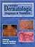 Current Dermatologic Diagnosis and Treatment