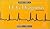 Pocketguide to ECG Diagnosis