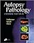 Autopsy Pathology: A Manual and Atlas