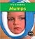 Mumps (It's Catching)