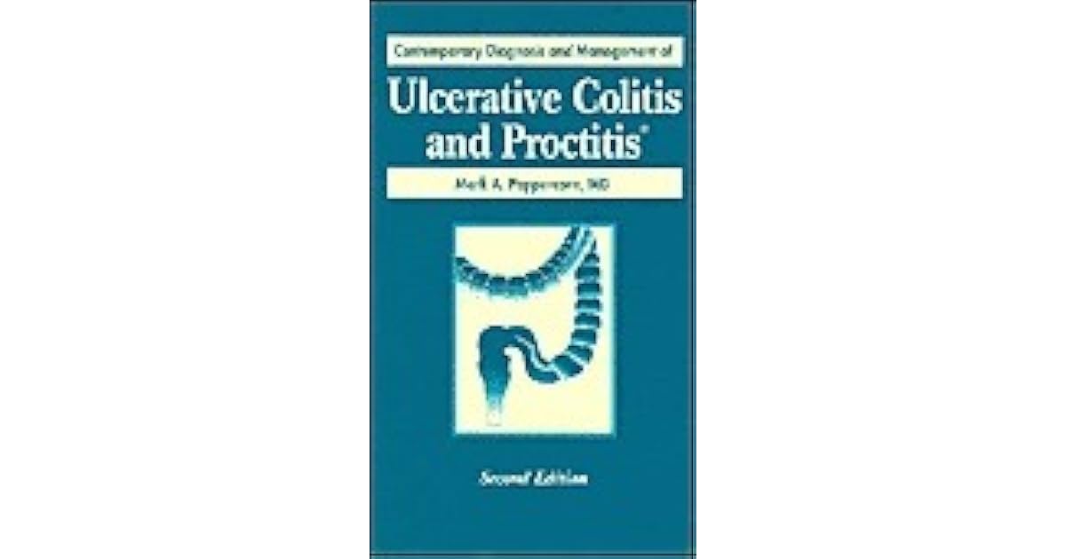Contemporary Diagnosis and Management of Ulcerative Colitis and
