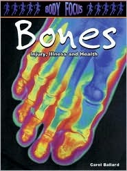 Bones: Injury, Illness and Health (Body Focus: The Science of Health, Injury and Disease)
