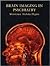 Brain Imaging in Psychiatry