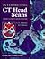 Interpreting CT Head Scans: A Basic Guide to Image Analysis