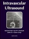 Intravascular Ultrasound