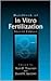 Handbook of In Vitro  Fertilization