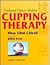 Traditional Chinese Medicine Cupping Therapy by Ilkay Zihni Chirali
