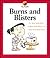 Burns and Blisters (My Health)