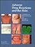 Adverse Drug Reactions and the Skin
