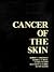 Cancer of the Skin by Robert J. Friedman