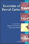 Essentials of Dental Caries
