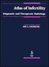 Atlas of Infertility: Diagnostic and Therapeutic Imaging
