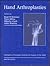 Hand Arthroplasties: Publis...