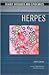 Herpes (Deadly Diseases and Epidemics)