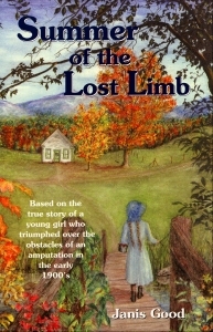 Summer of the Lost Limb (Paperback)