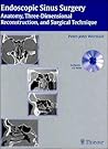 Endoscopic Sinus Surgery: Anatomy, Three-Dimensional Reconstruction, And Surgical Technique
