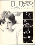 U2: The Early Days (Paperback)