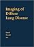 Imaging of Diffuse Lung Disease