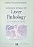 Colour Atlas of Liver Patho...