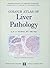 Colour Atlas of Liver Pathology by R.S. Patrick