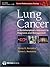 Lung Cancer: A Multidisciplinary Approach to Diagnosis and Management