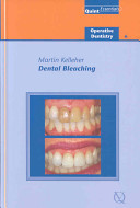 Dental Bleaching (Quintessentials of Dental Practice: Operative Dentistry 6)