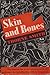 Skin And Bones by Thorne Smith