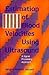 Estimation of Blood Velocities Using Ultrasound: A Signal Processing Approach