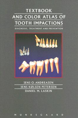 Textbook and Color Atlas of Tooth Impactions: Diagnosis, Treatment, Prevention