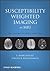 Susceptibility Weighted Imaging in MRI by E. Mark Haacke